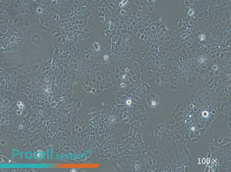 Ca Ski Cell Complete Medium - 2