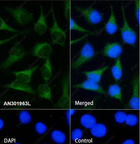 Recombinant Creatine kinase B type Monoclonal Antibody - 4