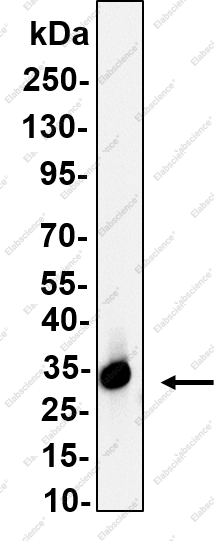 Recombinant NKX3.1 Monoclonal Antibody - 2