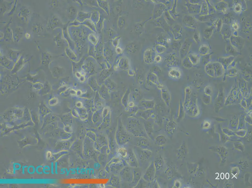 IGROV-1 Cell Complete Medium - 4