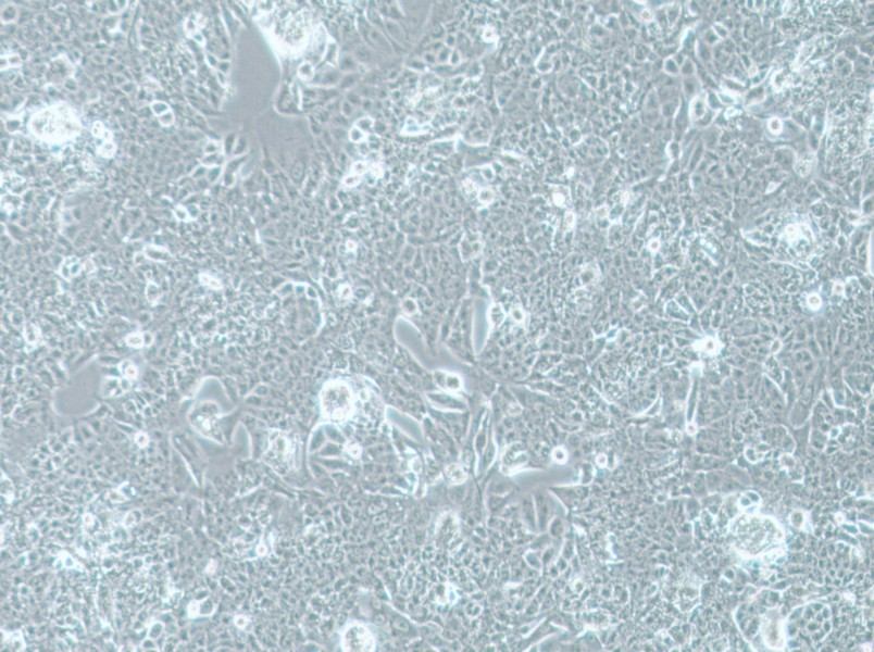 NCI-H1793 Cell Complete Medium - 2