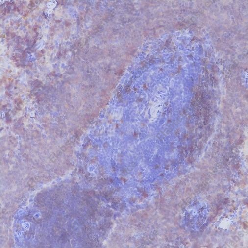 Recombinant CD20 Monoclonal Antibody - 4