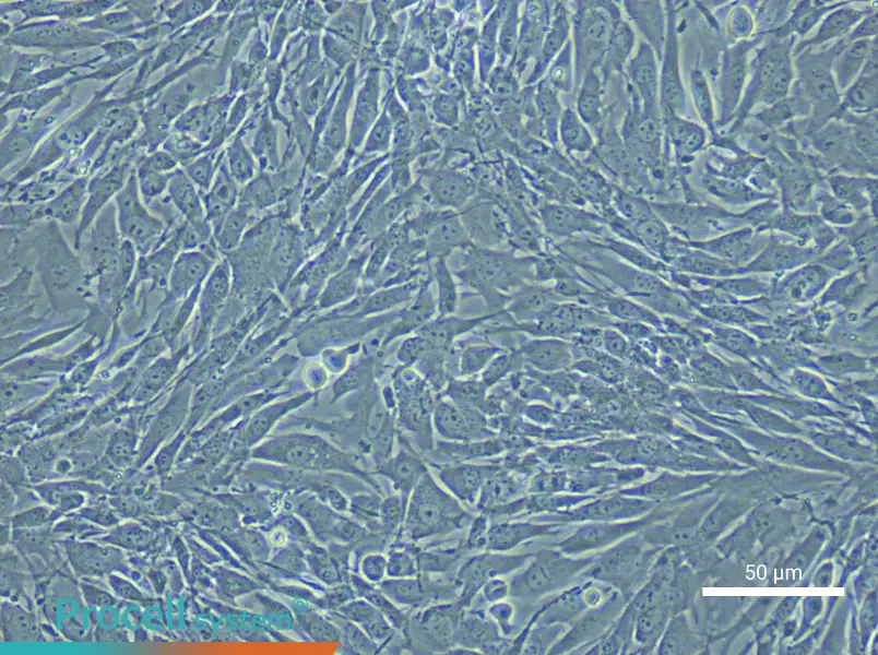 Mouse Pulmonary Great Artery Smooth Muscle Cell Complete Medium - small - 5