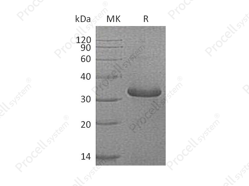 IGFBP1/IBP-1 (C-6His), Human, Recombinant