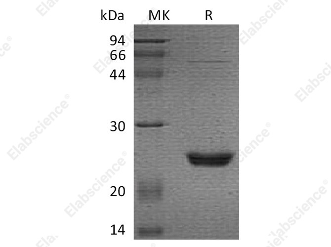 Recombinant Human UBE2M/UBC12 Protein - 1