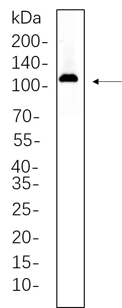 Recombinant Actinin-α2 Monoclonal Antibody-searchlist-1