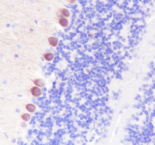 Recombinant GABA B Receptor 1 Monoclonal Antibody - 2