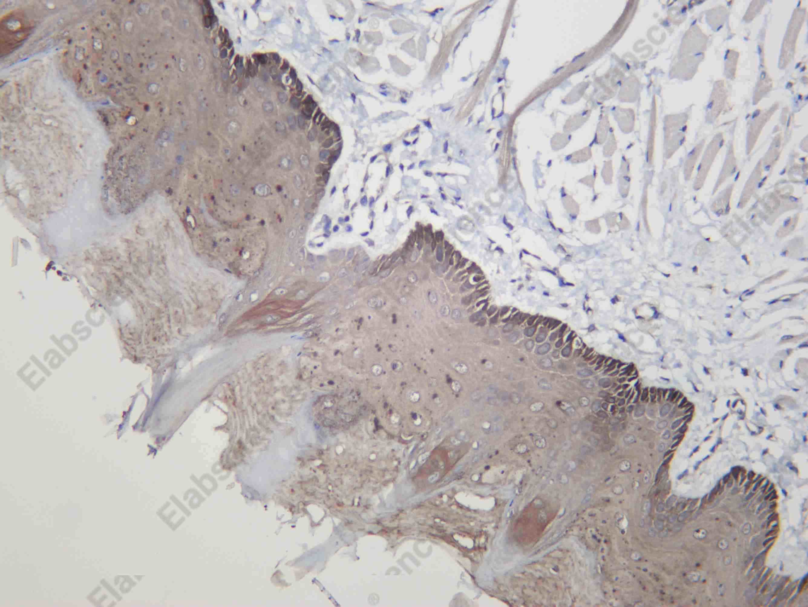 Recombinant IRS2 Monoclonal Antibody - 3