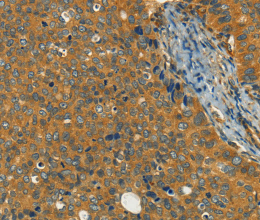 KLC1 Polyclonal Antibody - 2