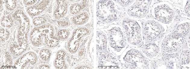 Recombinant Phospho-Chk1 (Ser317) Monoclonal Antibody - small - 2