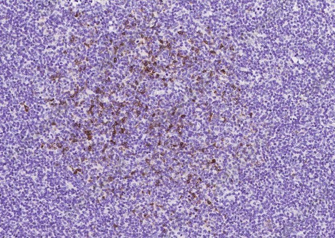 CD10 Monoclonal Antibody - 3