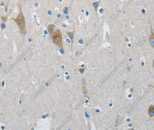 ATG4A Polyclonal Antibody - 3