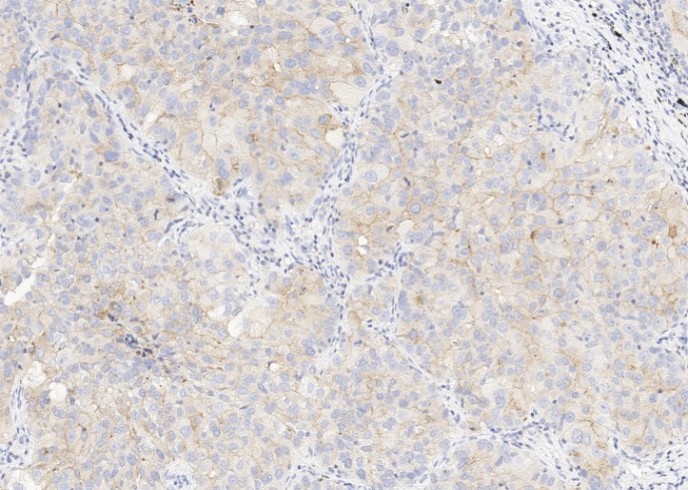 CD47 Monoclonal Antibody - small - 1