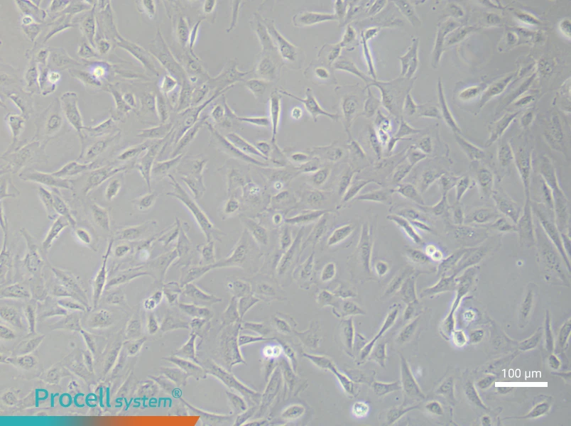 Human Keloid Fibroblast (Primary cell immortalization) Complete MediumHuman Keloid Fibroblast (Primary cell immortalization) Complete Medium - 2
