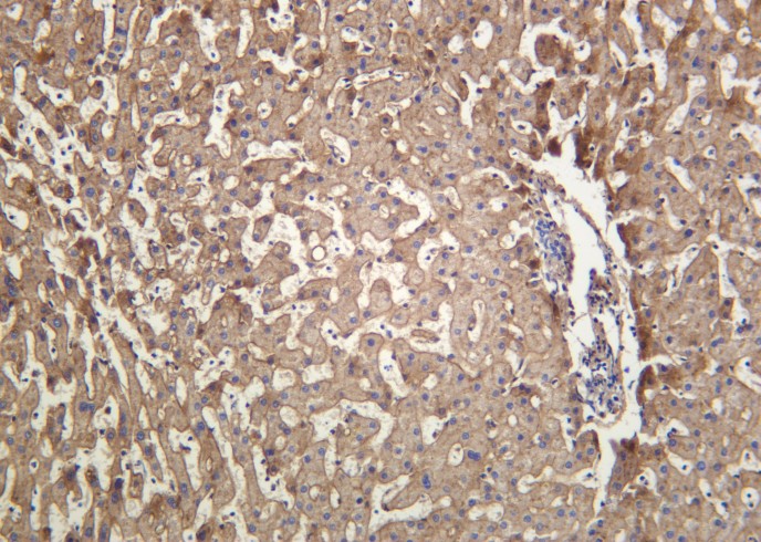 Recombinant ApoE Monoclonal Antibody - small - 2