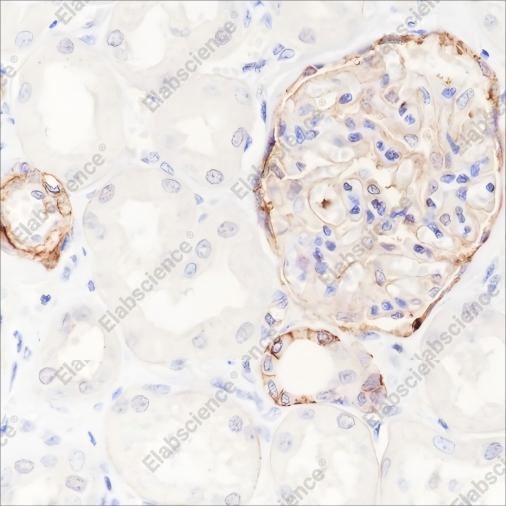 Recombinant CD239/BCAM Monoclonal Antibody - 2