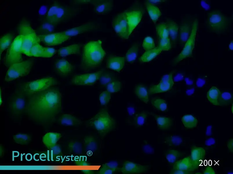 ACHN-GFP Cell Complete Medium - 5