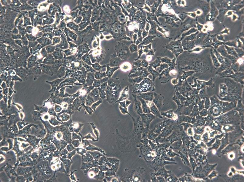 Ishikawa Cell Complete Medium - small - 4