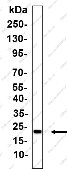 Recombinant HMGA2 Monoclonal Antibody - 1