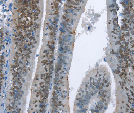 MCM6 Polyclonal Antibody - 3