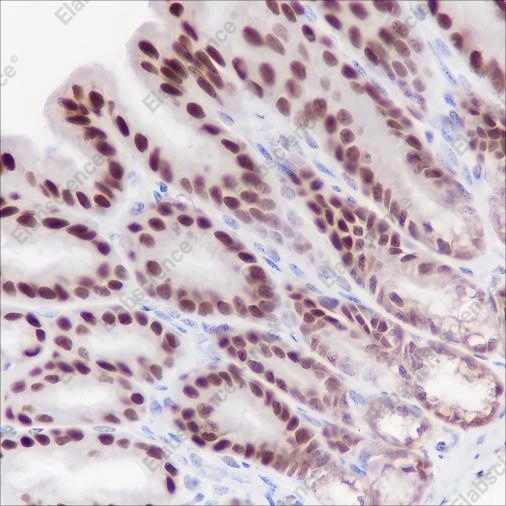 Recombinant Ku80 Monoclonal Antibody - 2