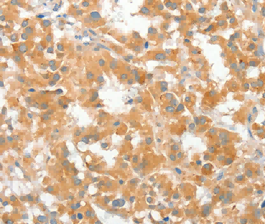 COL4A3BP Polyclonal Antibody - 2