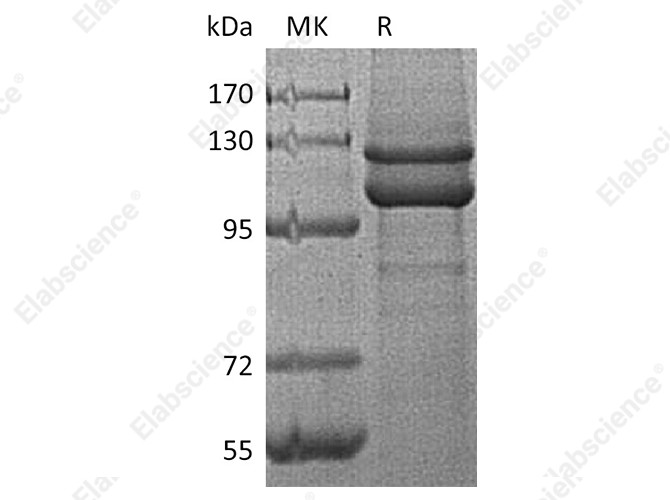 Recombinant Human E-Cadherin/CDH1 Protein (His Tag) - 1