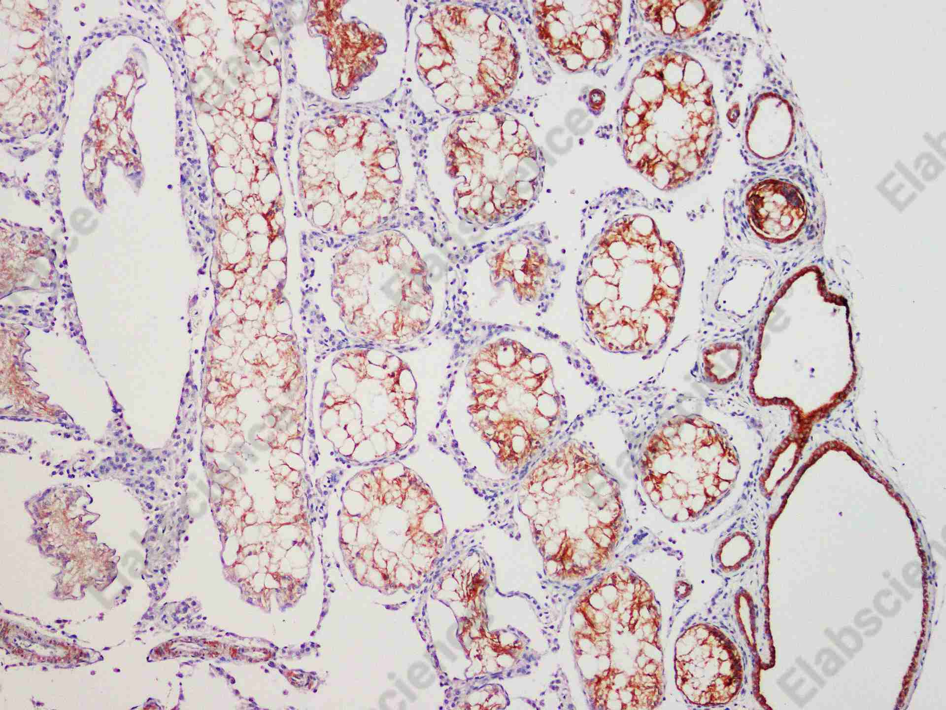 Recombinant Fascin Monoclonal Antibody - 1