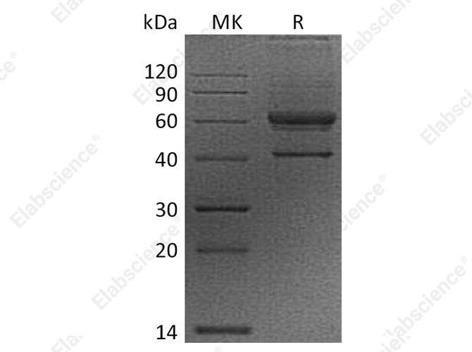 Recombinant Human VEGF-B/VEGFB Protein (Fc Tag) - 1
