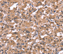 Histamine H1 Receptor Polyclonal Antibody - 2