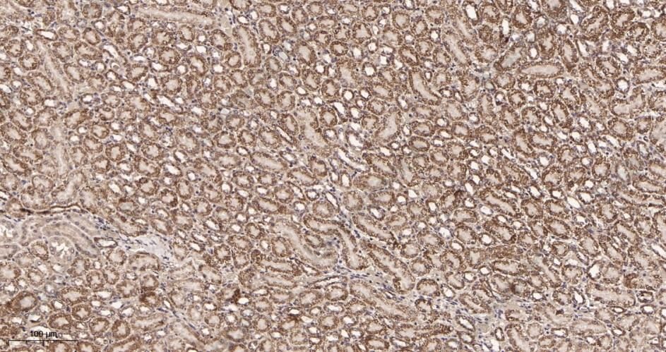 Recombinant Pyruvate Dehydrogenase E1 α Monoclonal Antibody - 3