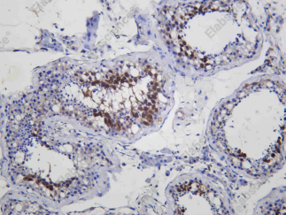 Recombinant PTTG1 Monoclonal Antibody - 2