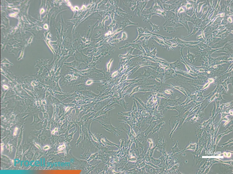 TtT/GF Cell Complete Medium - 2