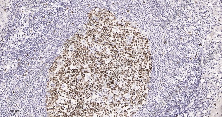 Recombinant Ki67 Monoclonal Antibody - 2