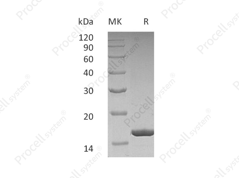 G-CSF/CSF-3/MGI-1G, Human, Recombinant