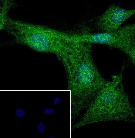 Recombinant BRN3A Monoclonal Antibody - 3