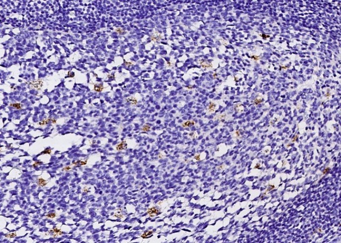 Recombinant FABP4/ALBP/A-FABP Monoclonal Antibody - small - 3