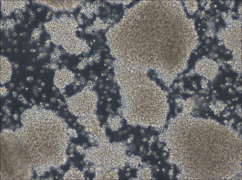 NCI-BL2009 Cell Complete Medium - 2