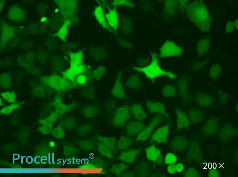 B16-F10-GFP - 4