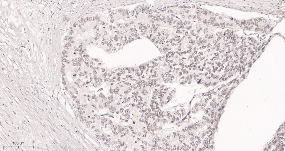 Recombinant KDM1A Monoclonal Antibody - small - 3
