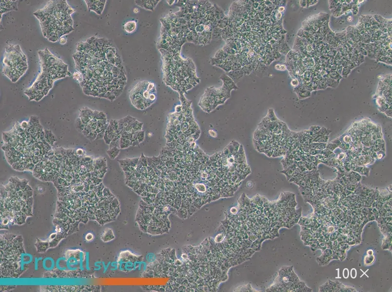 BT-474 [BT474] Cell Complete Medium - 2