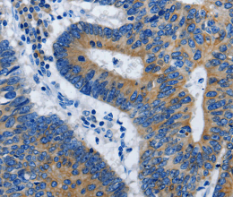 BPIFB3 Polyclonal Antibody - 2