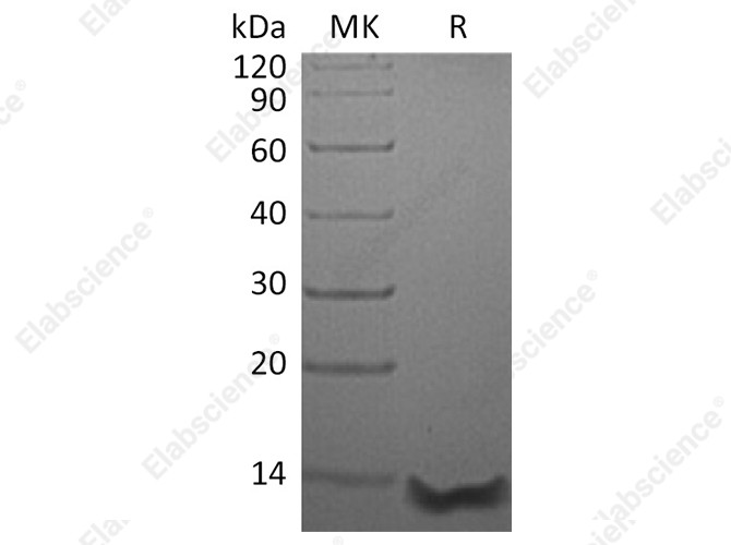 Recombinant Human Eotaxin-3/CCL26 Protein (aa 27-94) - 1
