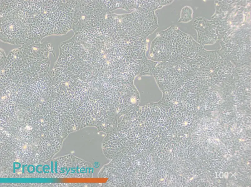 HCT-8 [HRT-18] Cell Complete Medium - 1