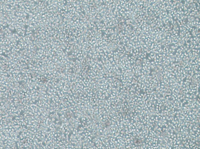 SKNO-1 Cell Complete MediumSKNO-1 Cell Complete Medium - 2