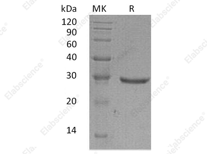 Recombinant Human GLIPR1 Protein (His Tag) - 1