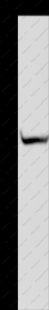 GYS1 Polyclonal Antibody - 1