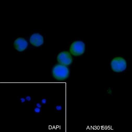 Recombinant MALT1/MLT Monoclonal Antibody - 2