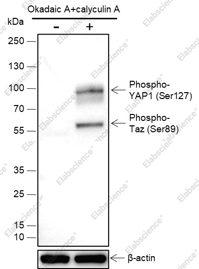 Recombinant Phospho-YAP1 (Ser127) Monoclonal Antibody - 1
