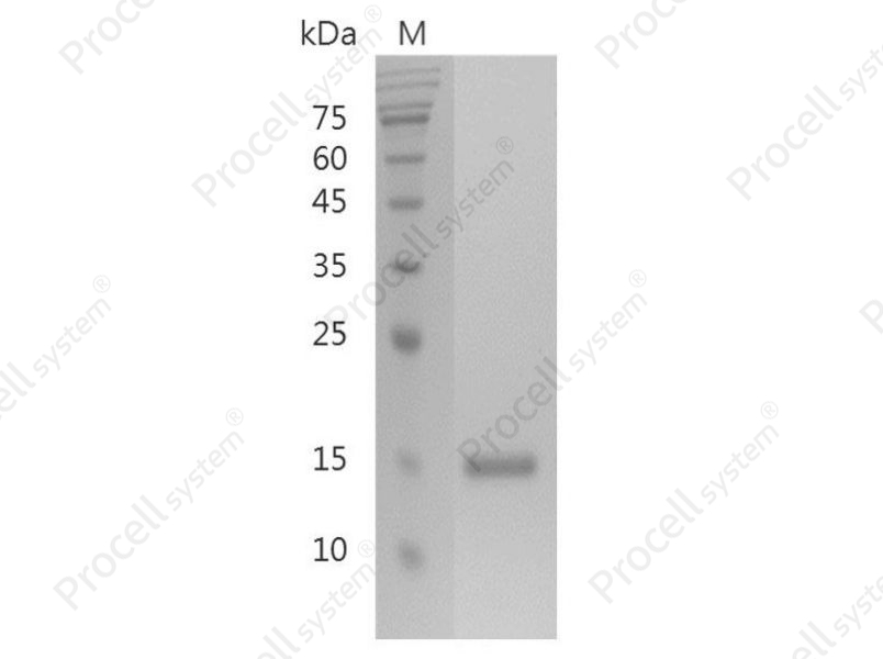 Galectin-1/LGALS1, Human, Recombinant